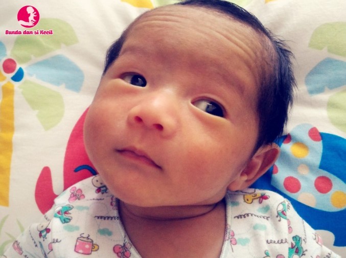 Mata Bayi Baru Lahir Juling? Ini Penjelasan dan Kapan Harus Waspada